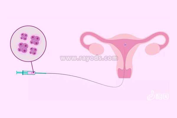 黄体功能不全_女孩子宫切除_试管移植哪种胚胎成功率高？冻胚以及囊胚移植